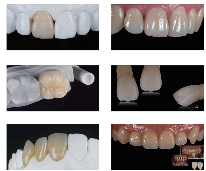 C14 Emax Glass Ceramic Lithium HT/LT Transparency Cerec blocks Dislicate CAD/CAM