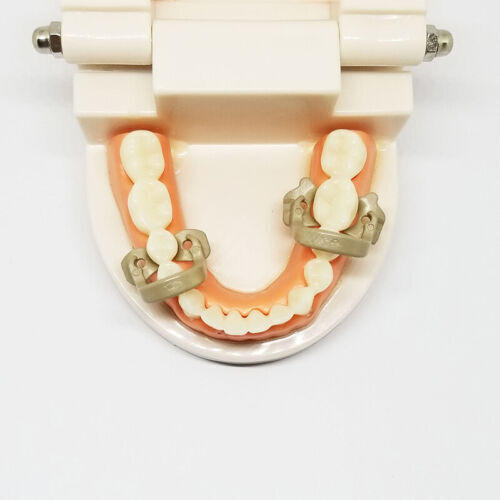 Dental Resin Soft Clamp Universal Rubber Dam Barrier Clips For Molar Premolar