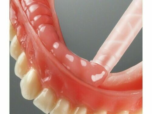 MolloPlast B Silicone Based Permanant Soft Reline Denture Material VARIOUS PACKS