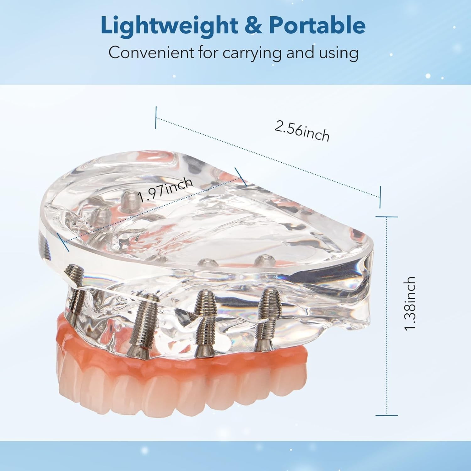 Dental Implant Model Overdenture All-on-4 All-on-6 treatment Demo With 4/6 Screw