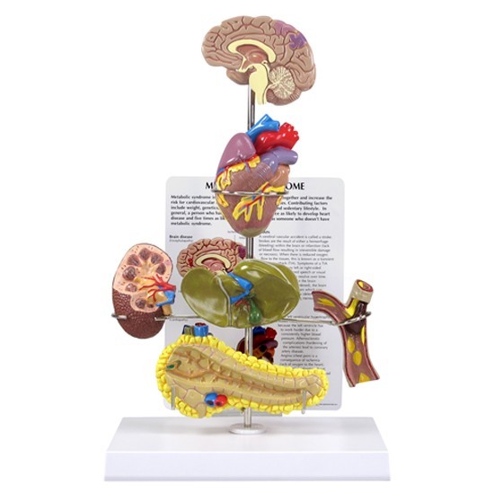 Metabolic Syndrome GPI Organ Model Set LFA#4020 Make Us an Offer! SEE VIDEO