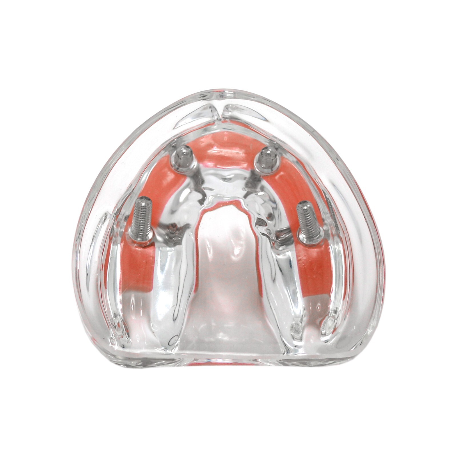 Dental All-on-4 Overdenture Implant Model, Upper/Lower Jaw-Clear,With 4 Screw