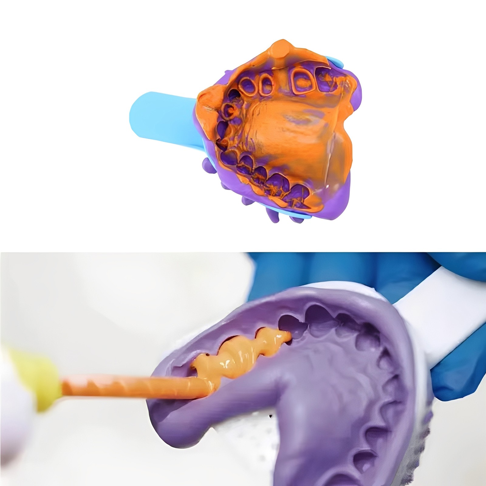 Dental VPS Impression Material Light Body Regular Set