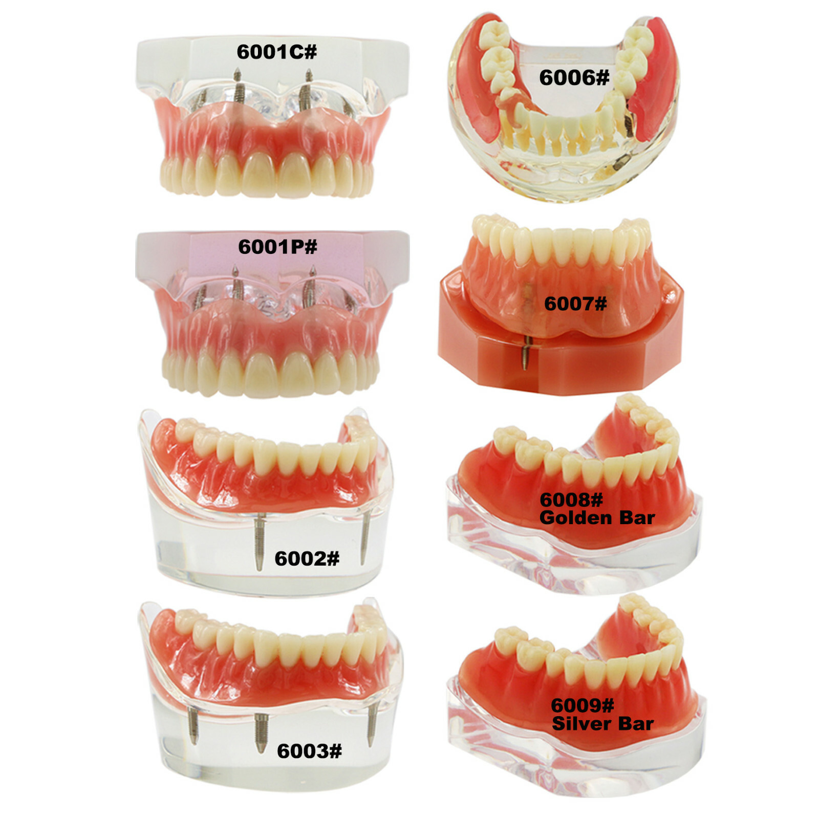 Dental Teeth Model 2 4 Implant Overdenture Typodont Restoration Demo Upper Lower