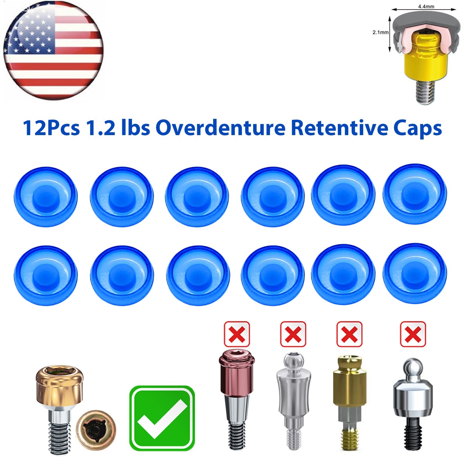 US Dental Overdenture Locator Universal Implant Retention Caps 1.2lbs Blue