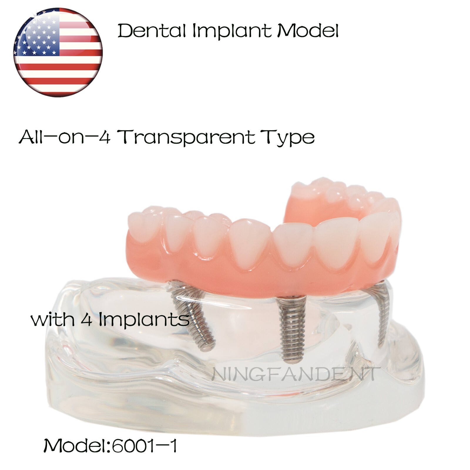 US Dental Implant Demo All-On-4 Treatment Repair Model Upper/Lower Jaw Kit,Clear
