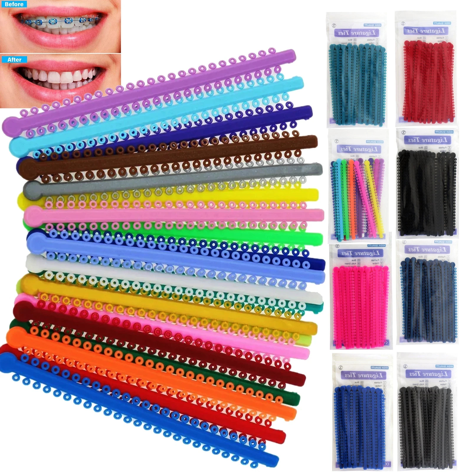 Dental Orthodontic Elastic Rubber Bands Braces Ligature Ties Single/Double Color