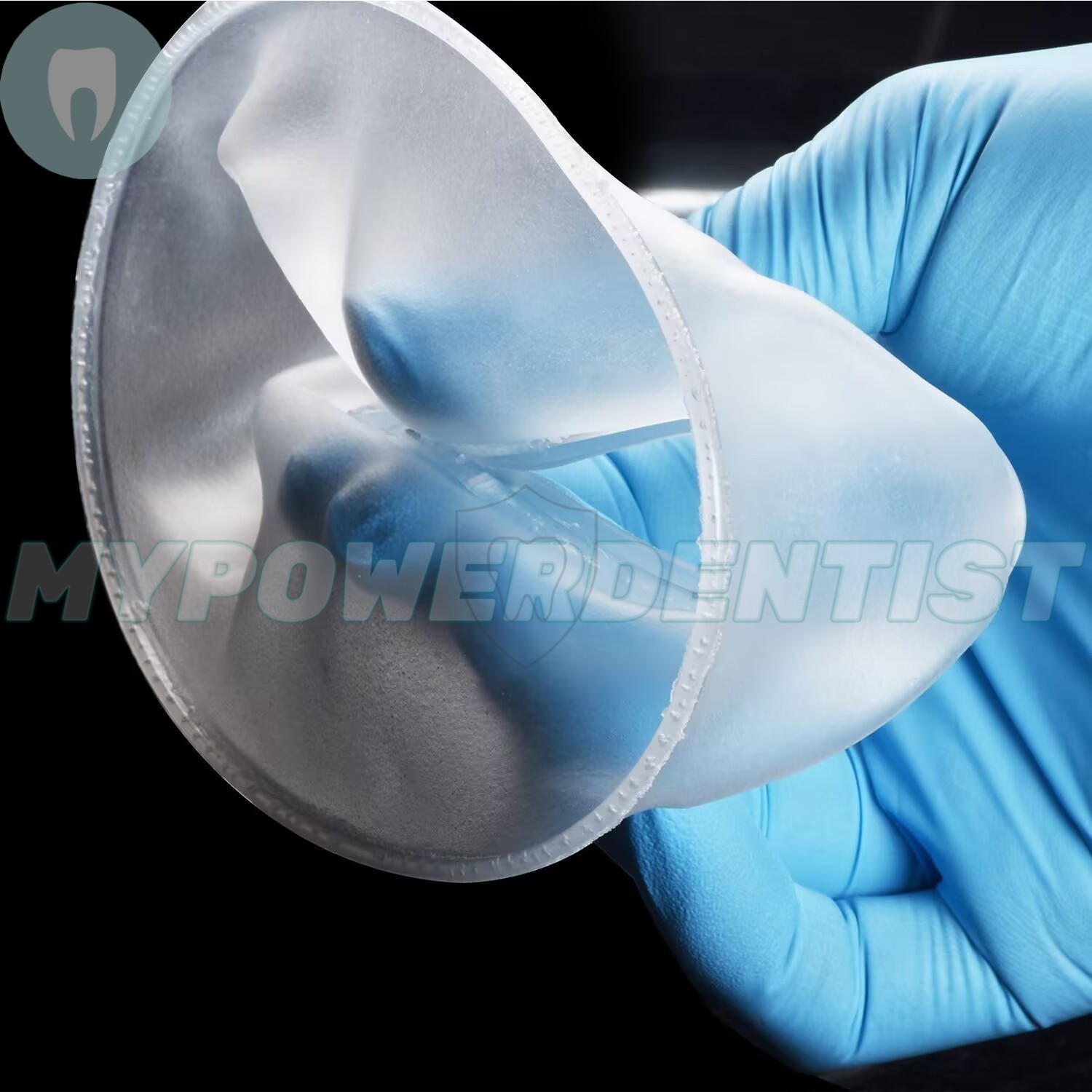 Dental O Shape Mouth Opener Lip Cheek Retractors Intraoral Lip Expander Opener