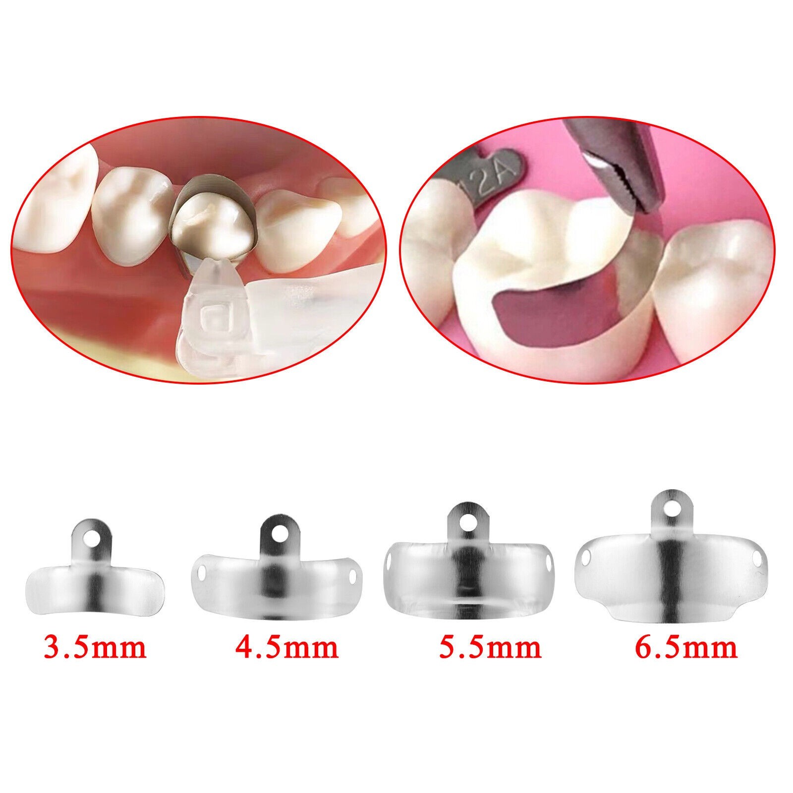 Dental Matrix Bands Sectional Matrices Contoured Refill 3D Holes Fit Garrison