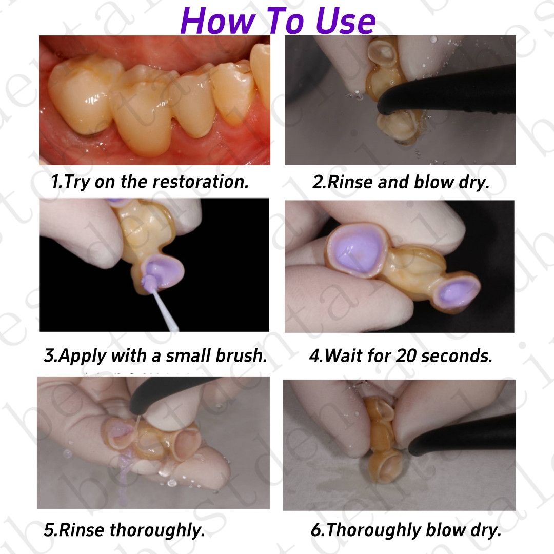 Dental Cleaning Paste Clean Bonding Surfaces After Try-in Ivoclean Crowns Veneer
