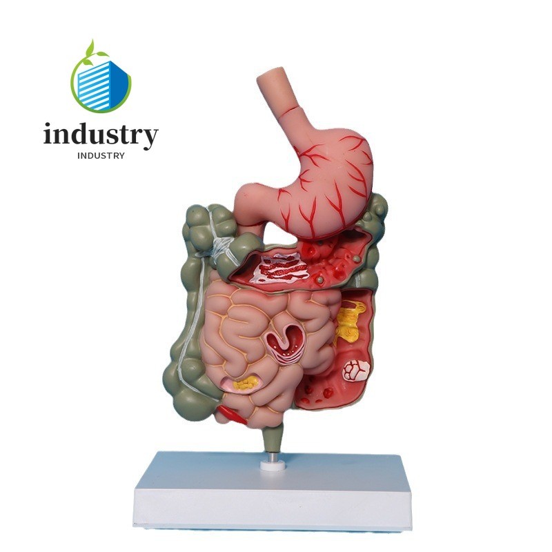 Human Digestive System Large Intestine Cecum Model Teaching Model