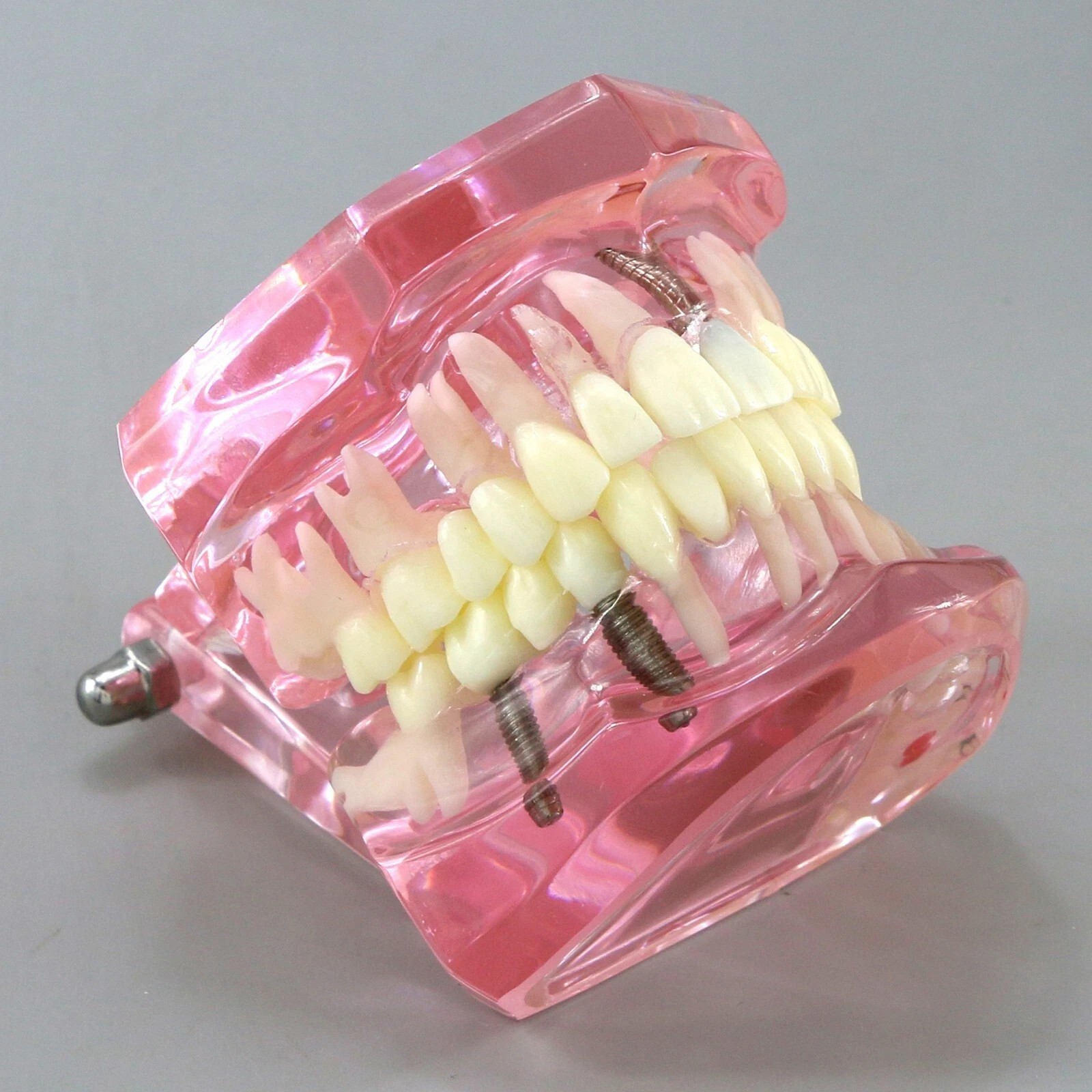 Dental Implant Teeth Model Teach Study Demo Restoration Pathology #2001 Pink
