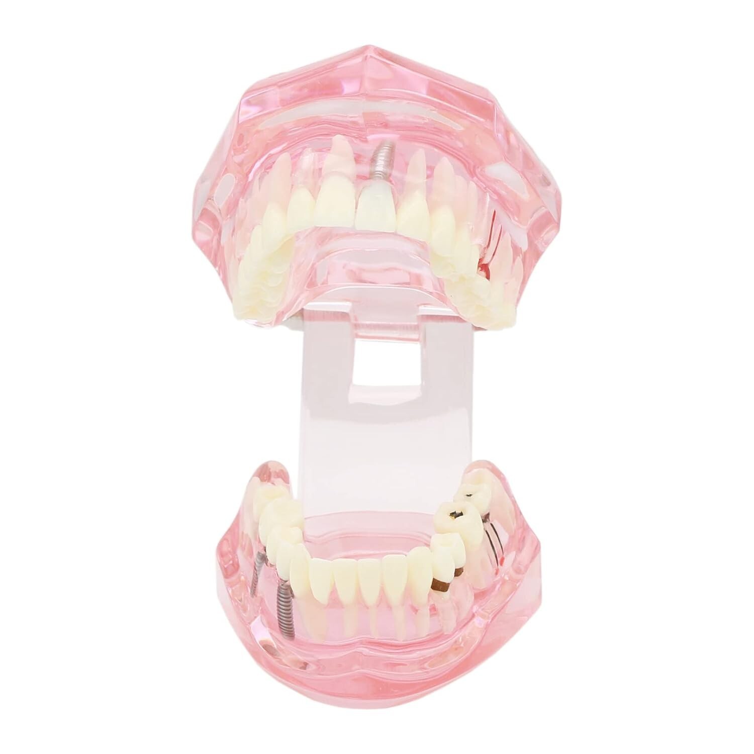 Dental Teeth Model Teach for Study Demo Restoration Pathology Bridge M2001 Pink