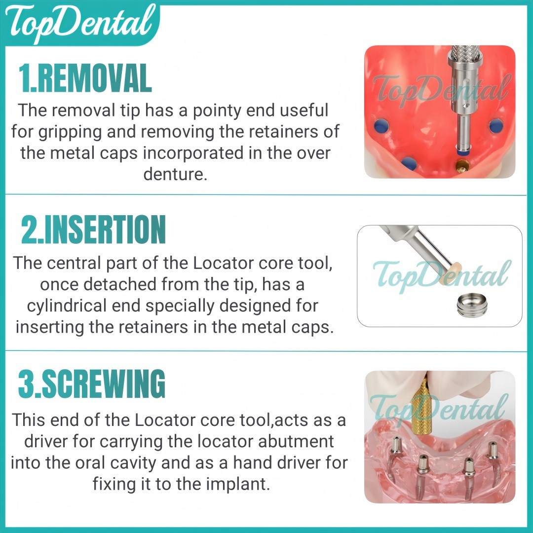 Dental Retention Cap Insertion Locator Core Tool Overdenture Abutment Fit OSSTEM