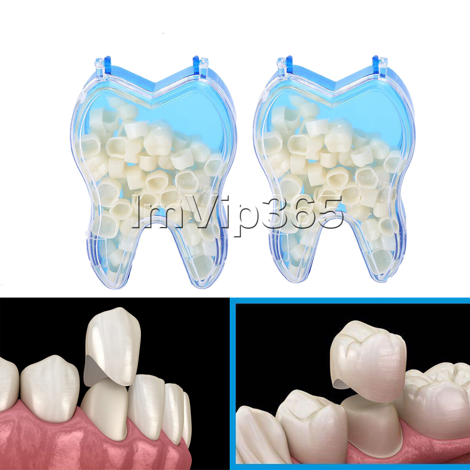 Temporary Crowns Anterior Posteriors Resin Tooth Teeth Polycarbonate Caps Dental