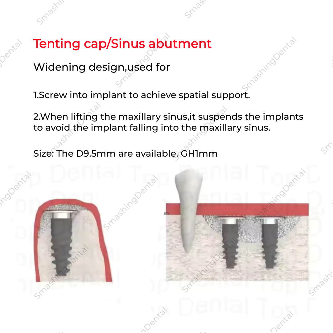 Dental Im plant Repair Accessories Lift Temporary Abutment 9.0mm Fit Oss