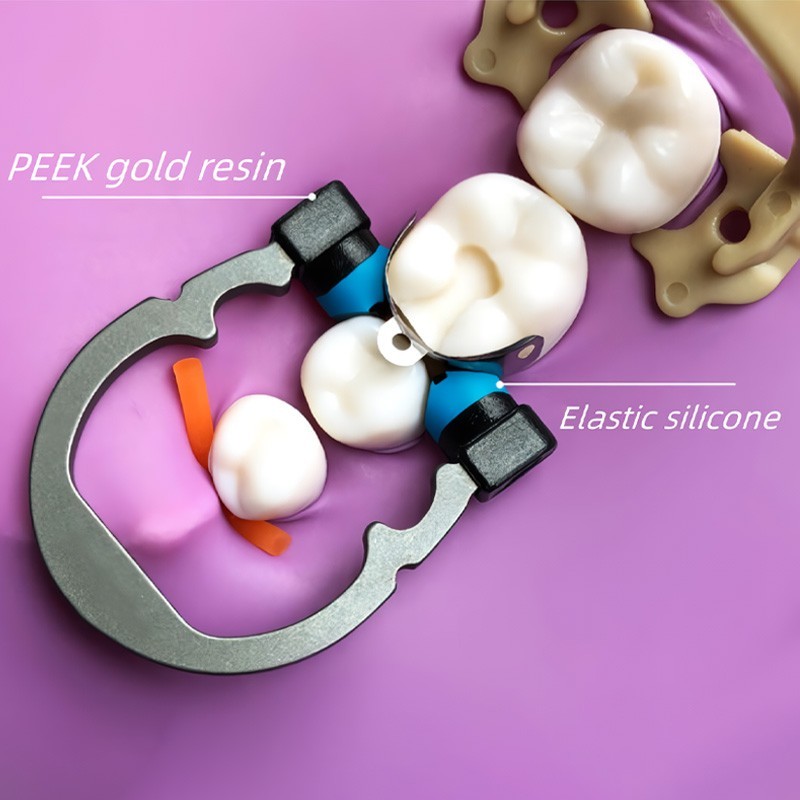 Dental Matrix Ring Titanium Clamp Sectional Matrice Clamp Fit Palodent V3 System