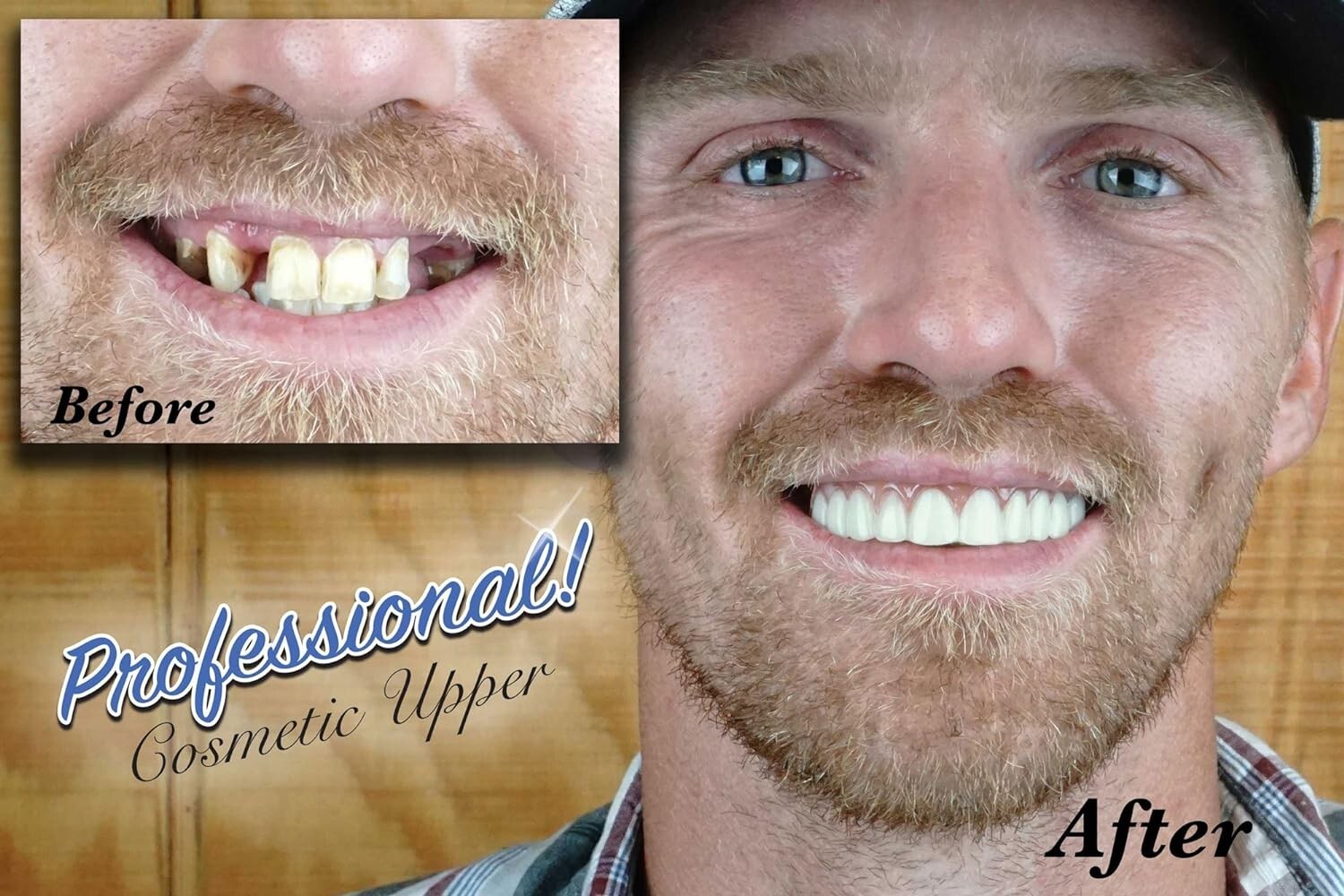 Professional Cosmetic Upper – New from ! Hand Crafted Detail, Custom fit at H…