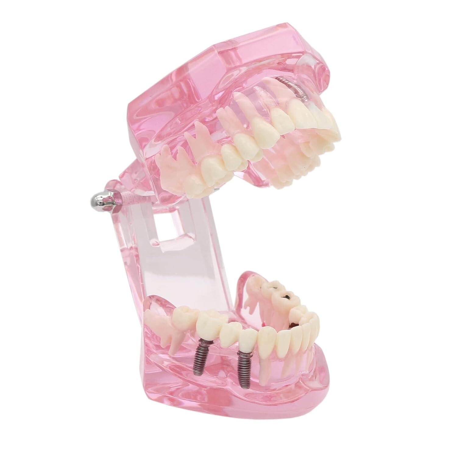 Dental Teeth Model Teach for Study Demo Restoration Pathology Bridge M2001 Pink