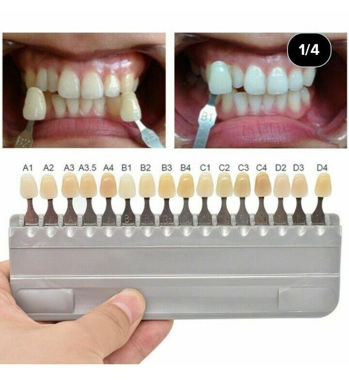 Dental Denture Teeth Acrylic Resin Teeth Full Set Upper Lower A1/A2/A3 3/8/16Set