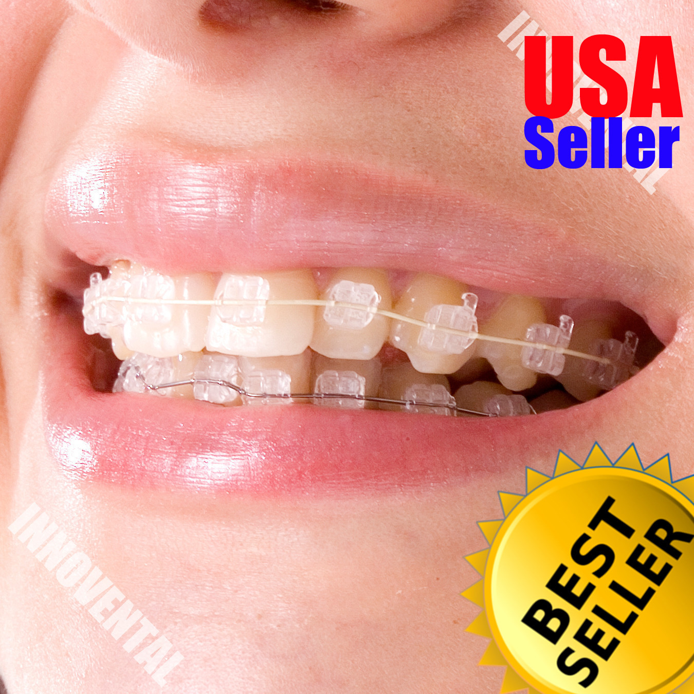 J&J Ortho™ CLARO™ Crystal Sapphire Orthodontic Bracket (12 Brackets) Hubit