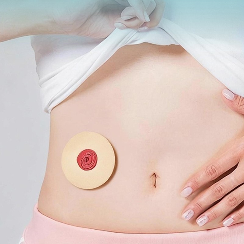 10Pcs Ostomy Paste Ring Baseplates Stoma Care Leak-Proof Ring For Ostomy