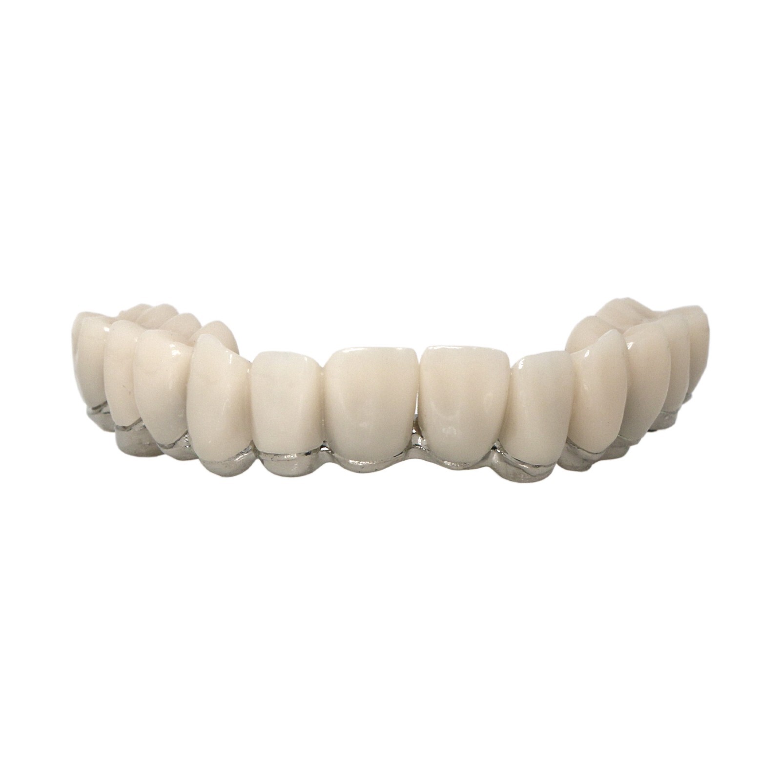 All-on-4 Overdenture Clear Model Dental Implant Upper Jaw Restoration 4 Screws