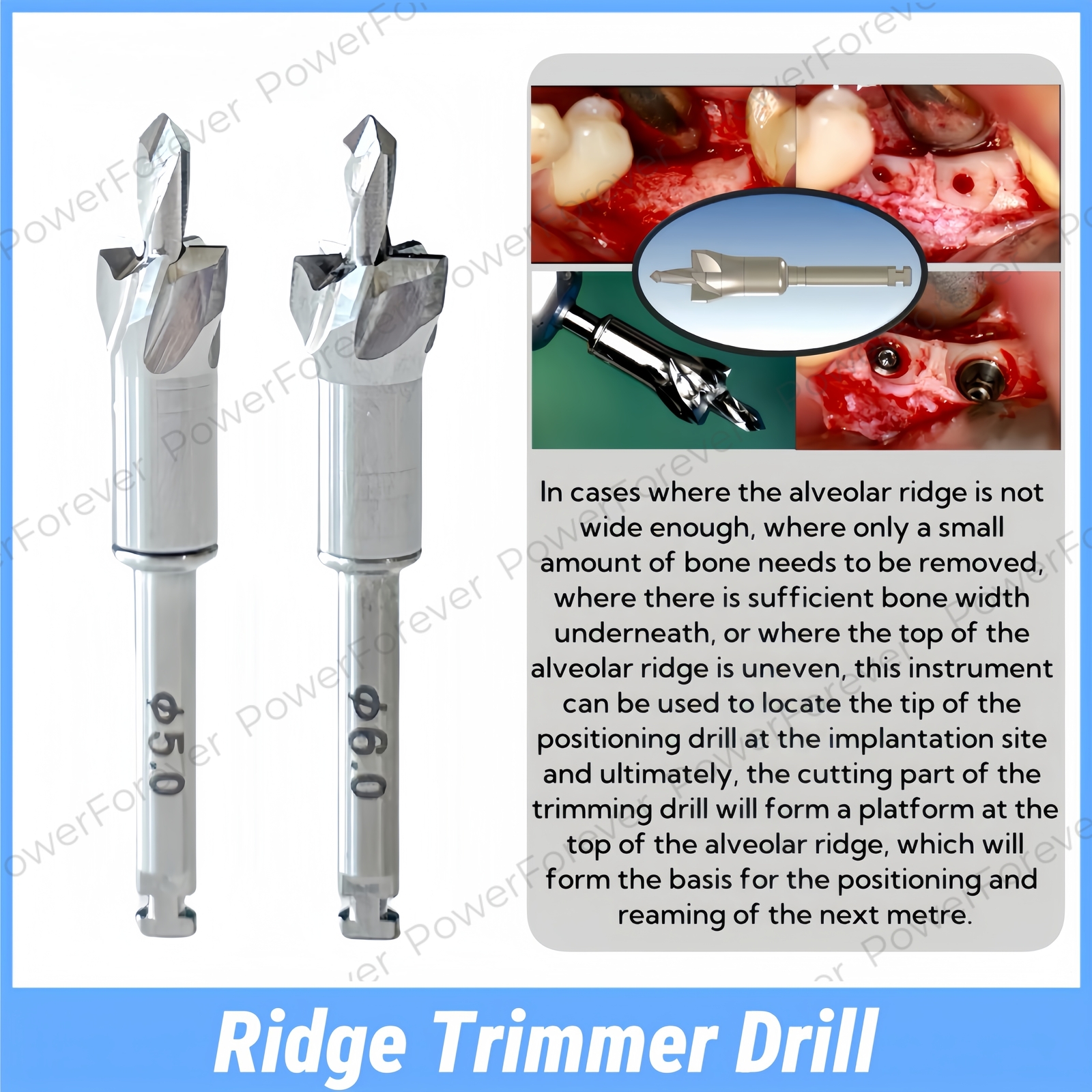 Implant Bone Profiler Dental Bone Mill Kit Sculpting Shaping Alveolar Ridge Tool