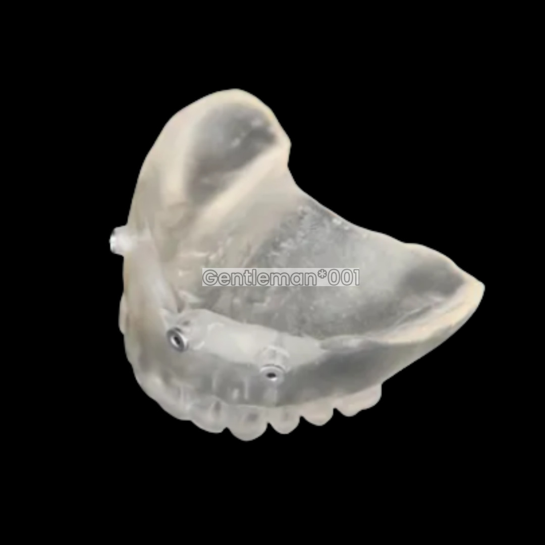 10Pcs Dental Digital Guided Sleeves Implant Template Fixed Universal ITI DIO DEN