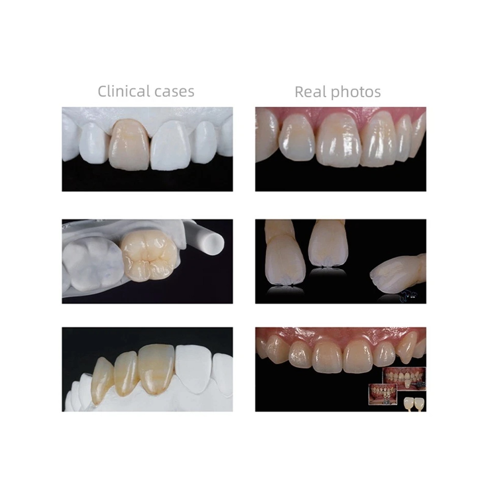 US C14 Glass Ceramic Blocks HT Lithium Disilicate CAD/CAM Cerec Blocks 5Pcs/Box