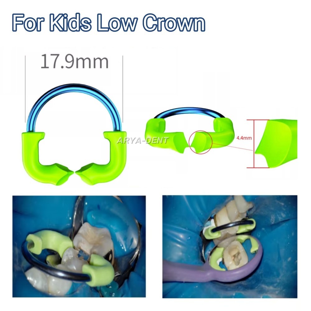For Kids Low Crown Matrix Retainer Clamping Ring Pediatric Teeth Restoration
