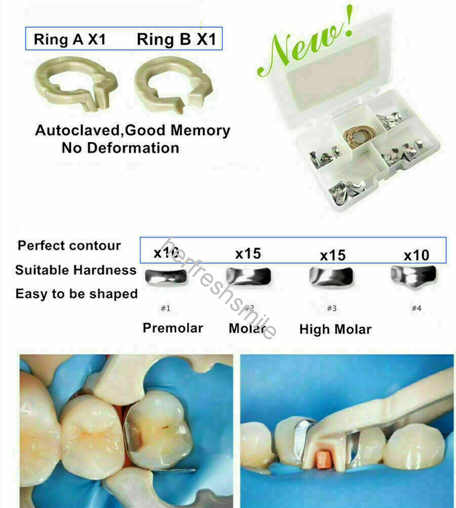 52Pcs Dental Sectional Matrix Matrices System Composite Resin Filling Dentpark