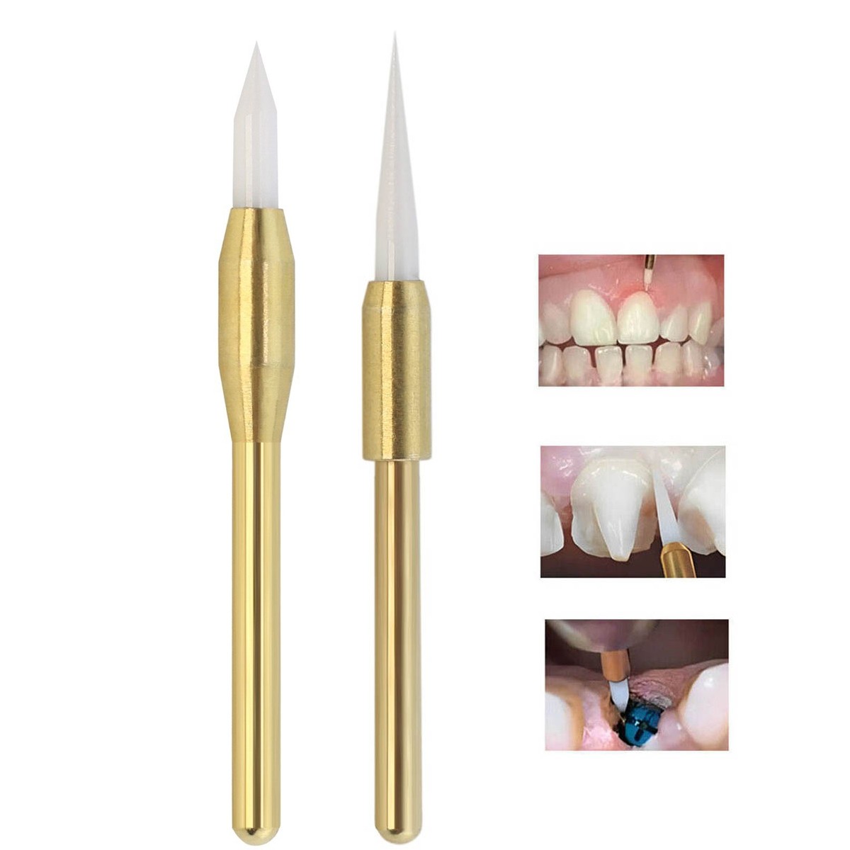Dental Soft Tissue Trimmer Ceramic Bur Gingival Gingivectomy 21/23mm