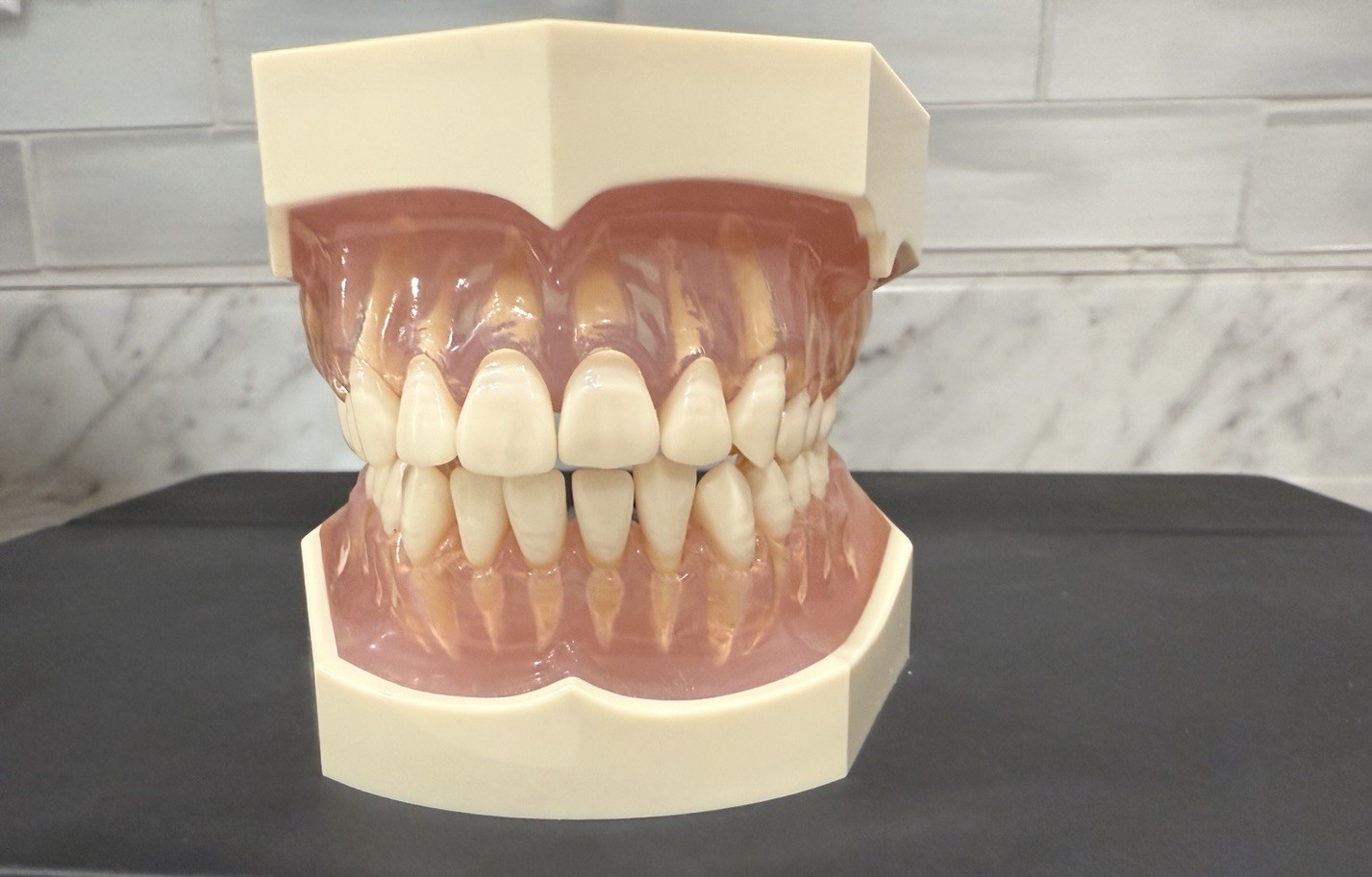 Periodontal Disease Simulated/ Removable Teeth Models, Colgate PT Ed With Brush