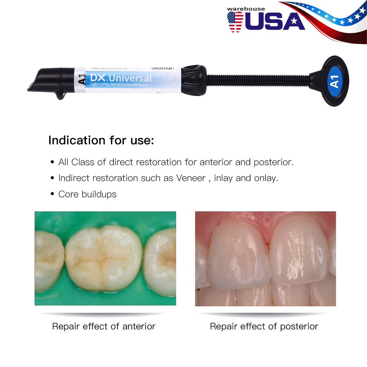 Dental Light Cure Universal Composite Resin Refill A1 Shade 4g/Syringe