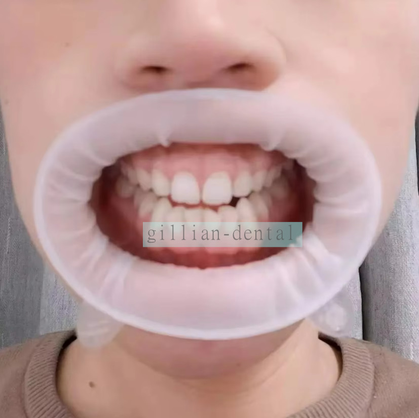 Ivoclar Vivadent Optragate Dental 3D Soft Lip Cheek Retractor Mouth Opener