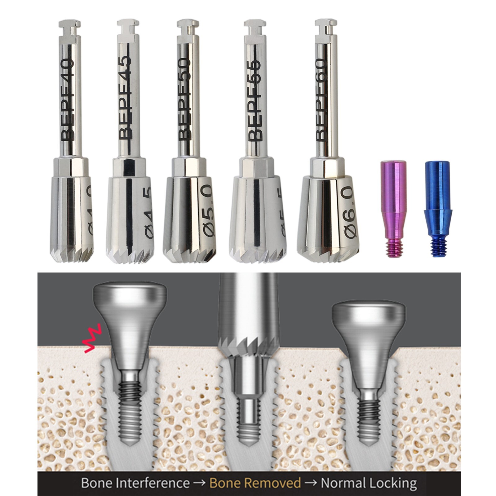 Implant Bone Profiler Guide Screw 4.0 4.5 5.0 5.5 6.0 Hiossen OSSTEM MIS Megagen