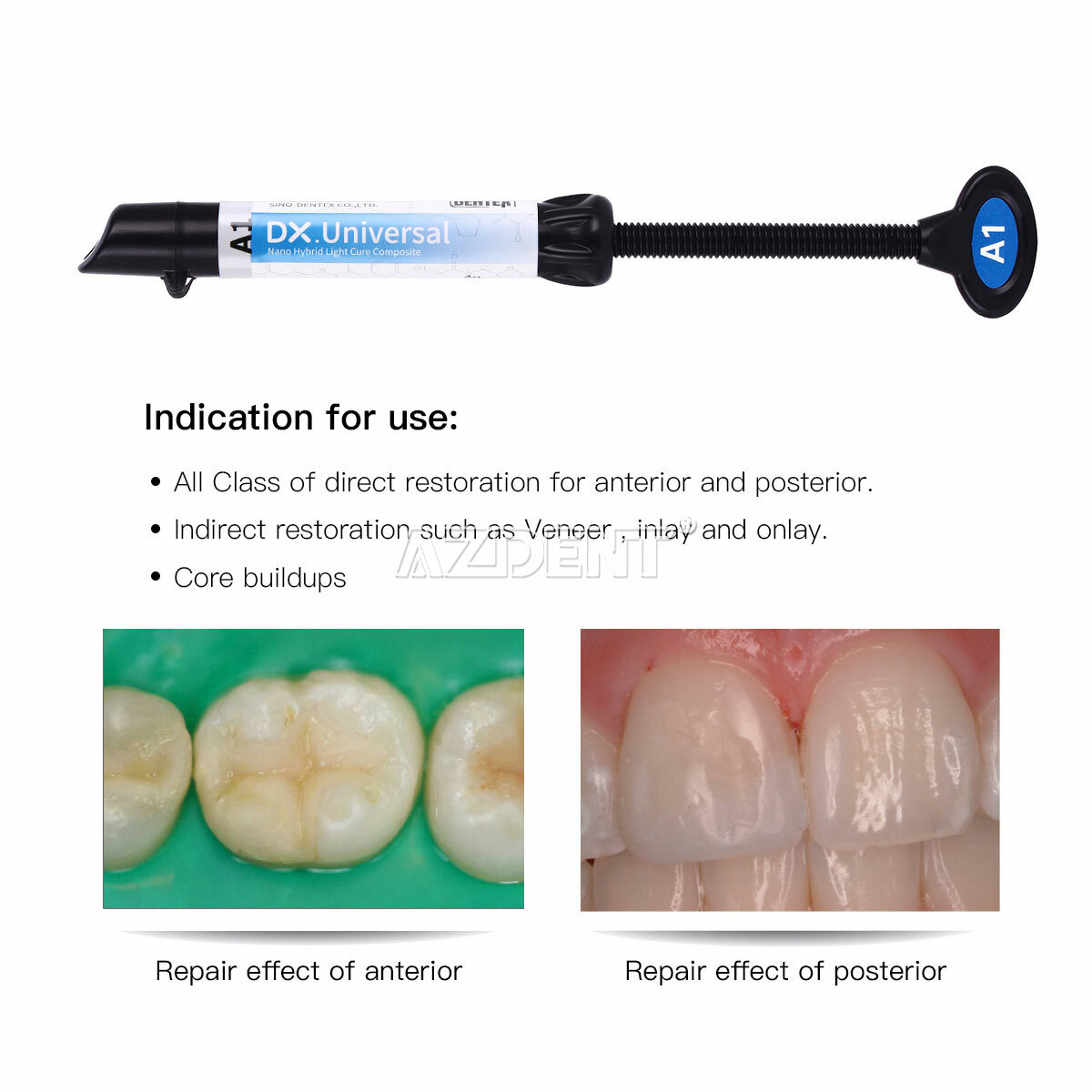 Dentex Dental Light Cure Composite Resin A1/A2/A3 Temp Fill/Dual Cure Flow Resin