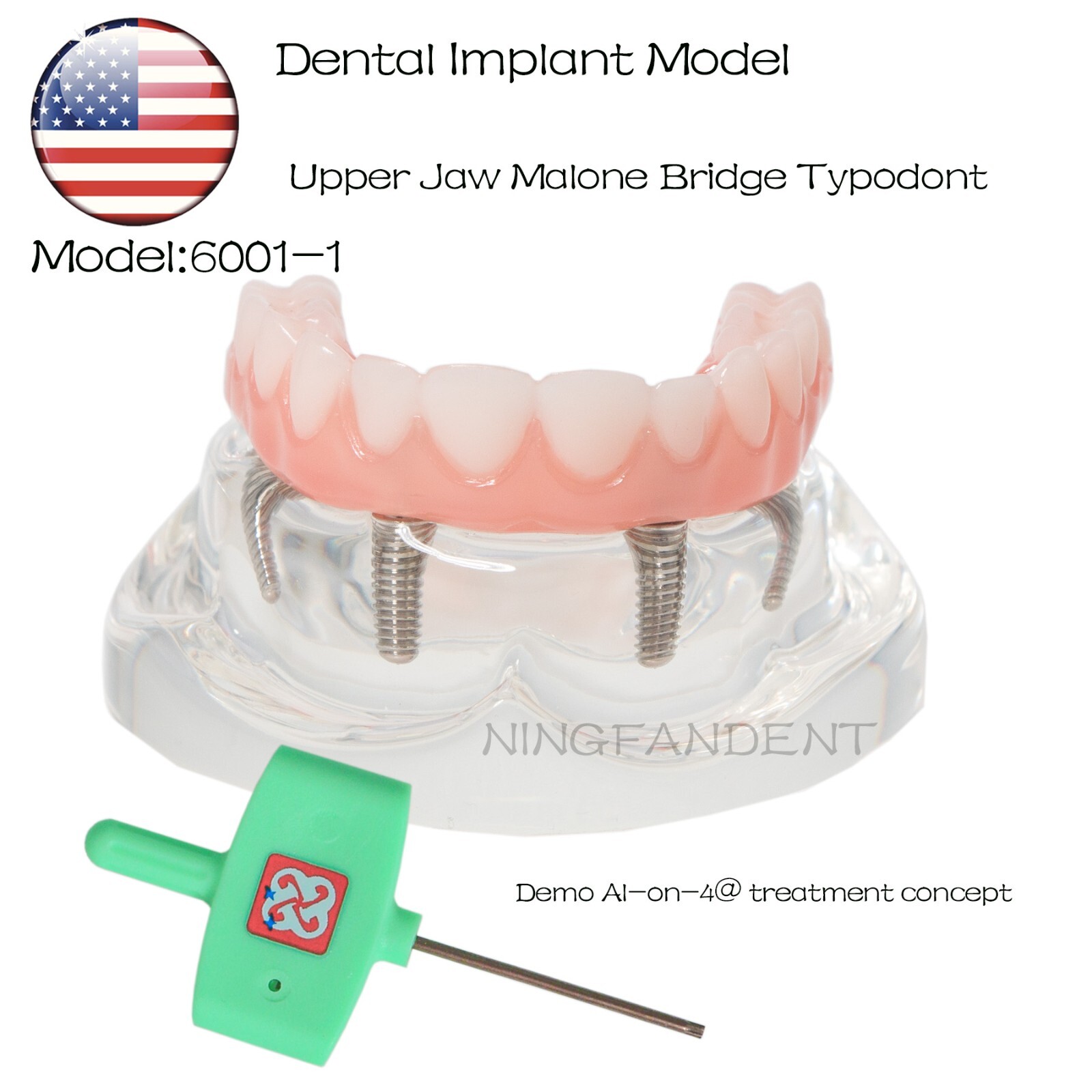 US Dental Implant Demo All-On-4 Treatment Repair Model Upper/Lower Jaw Kit,Clear