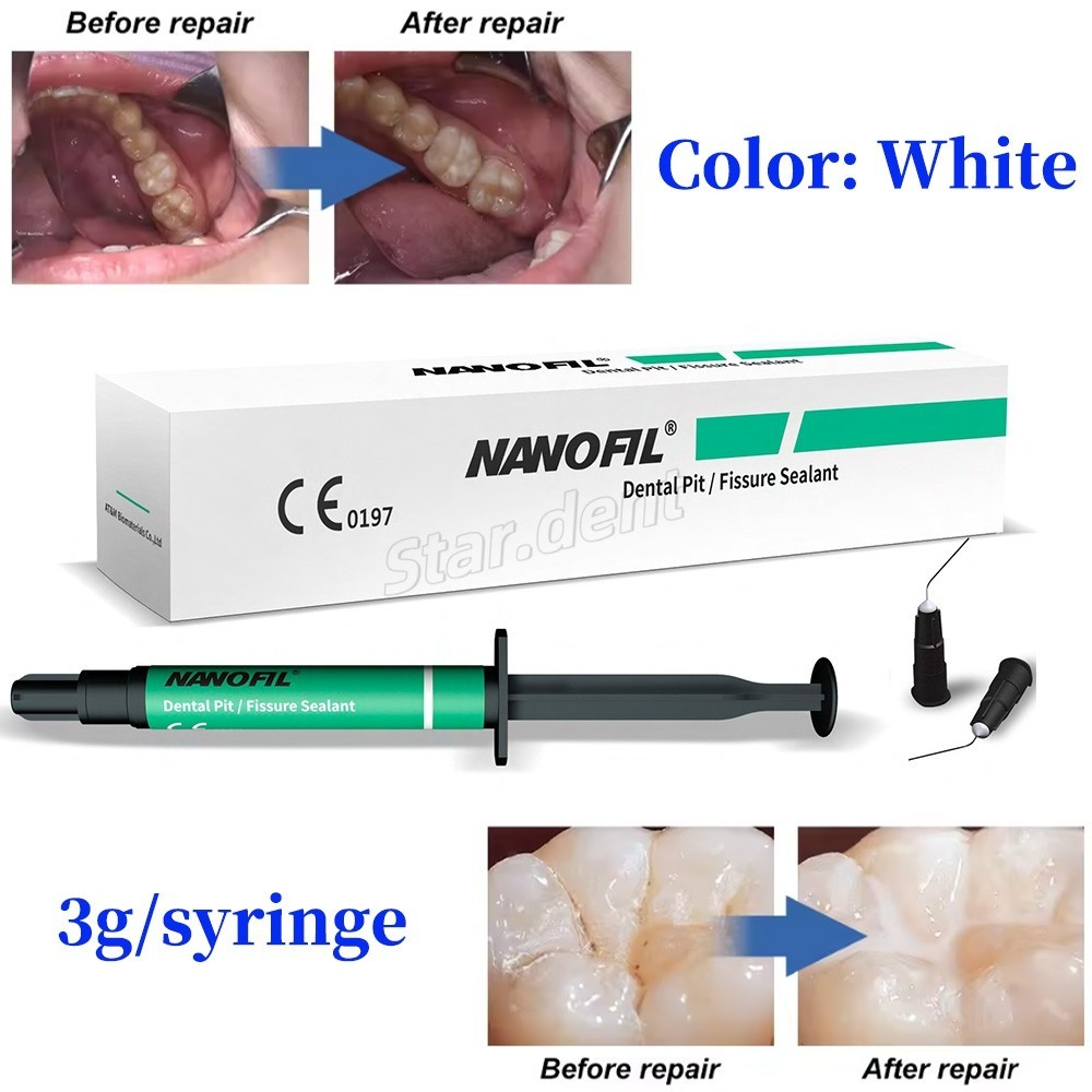 3g/syringe Dental Pit Fissure Sealant Light Cure Effective Cavity Protection