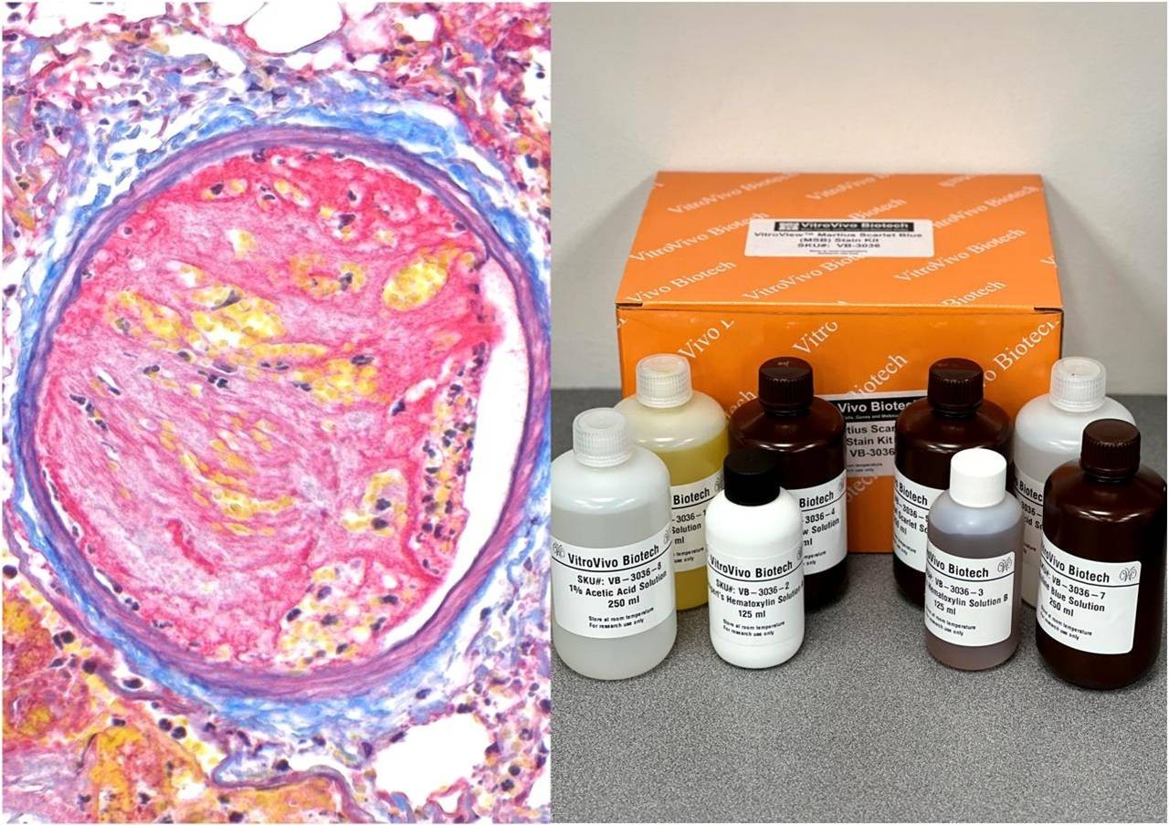 VitroView™ Martius Scarlet Blue (MSB) Stain Kit (Cat# VB-3036)