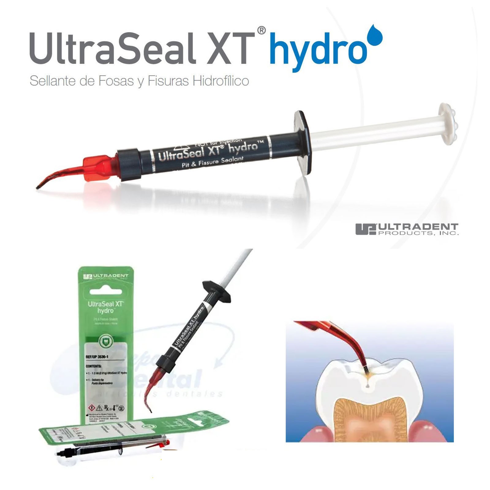 Ultradent UltraSeal XT Hydro Flowable Dental Sealant 1.2ml 4Pcs New