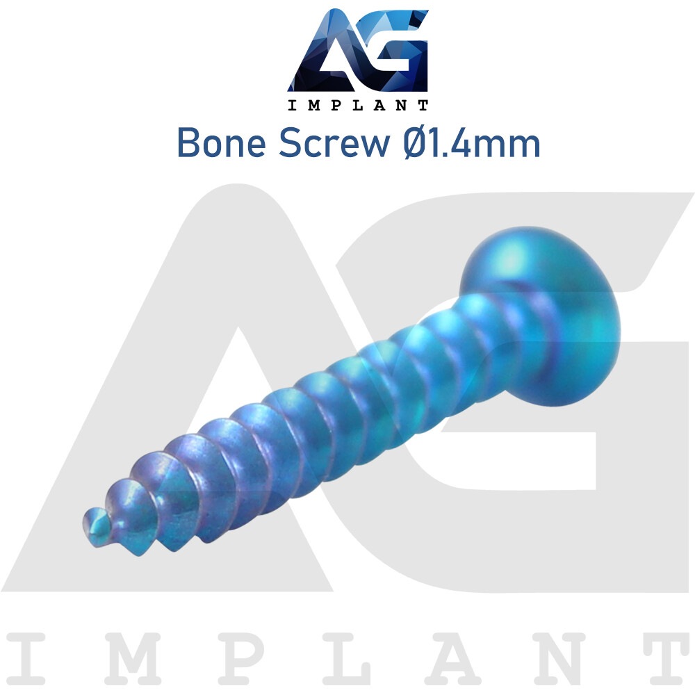 20 Titanium Screw Ø1.4mm Guided Regeneration GBR Dental Membrane Fix System