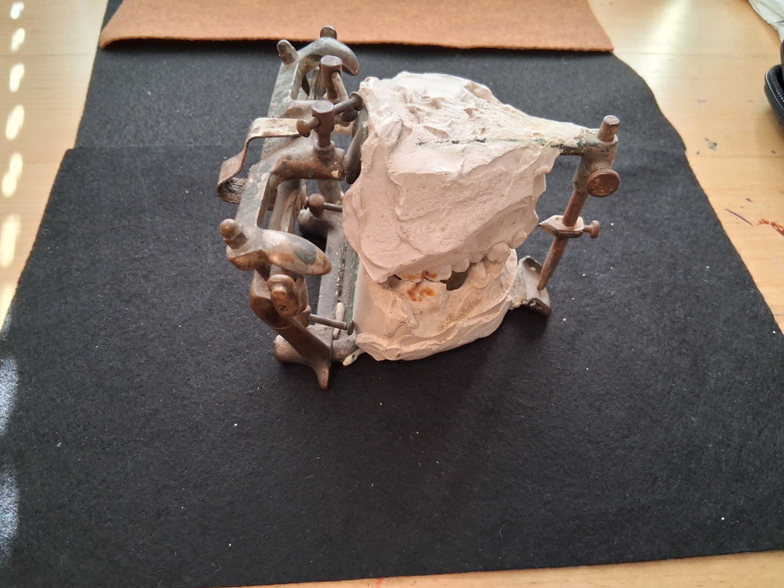 Antique dental articulator patented 1912. Dentists Supply co. New York