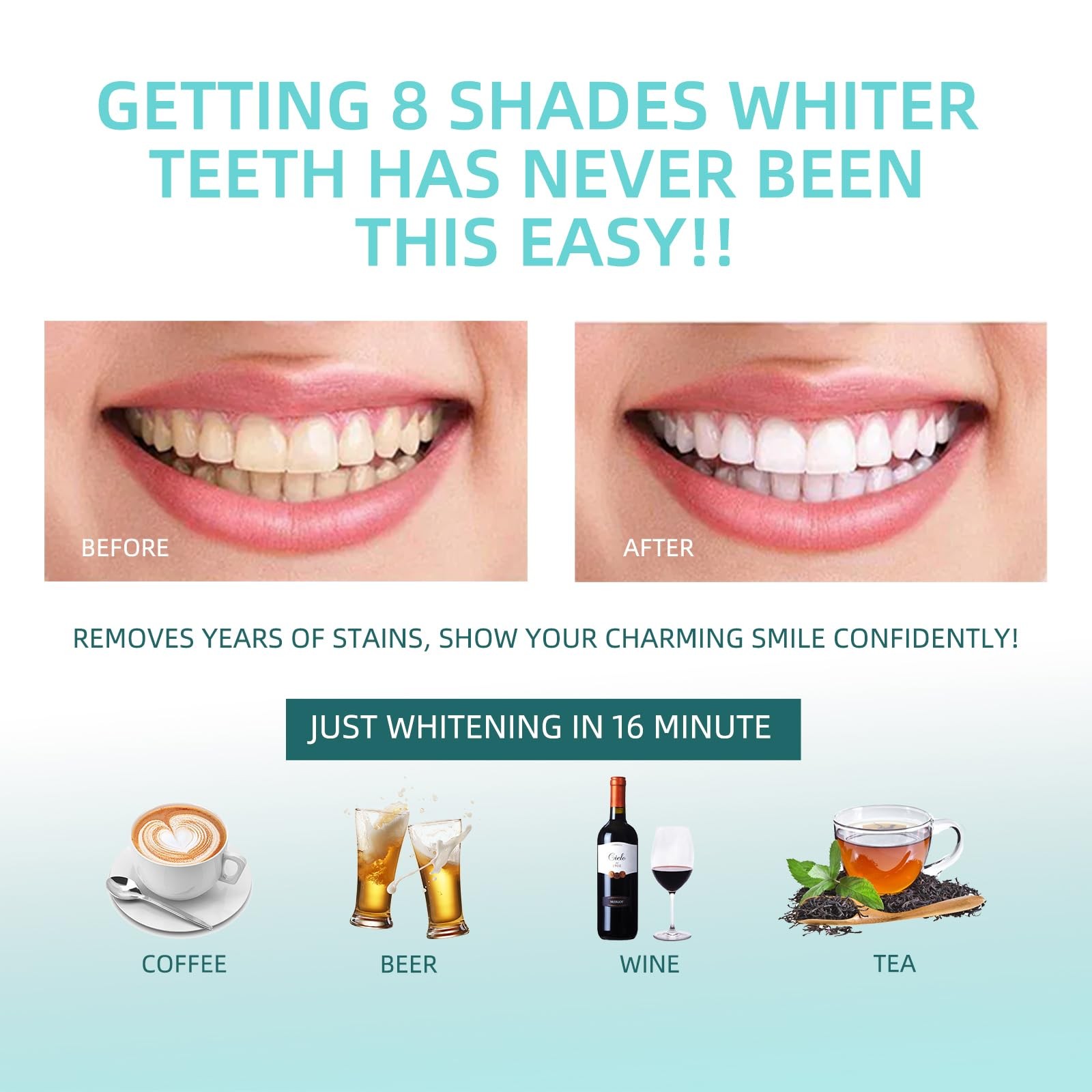 Teeth Whitening Kit with 32xLED Light Professional 1 Fl Oz (Pack of 1), White