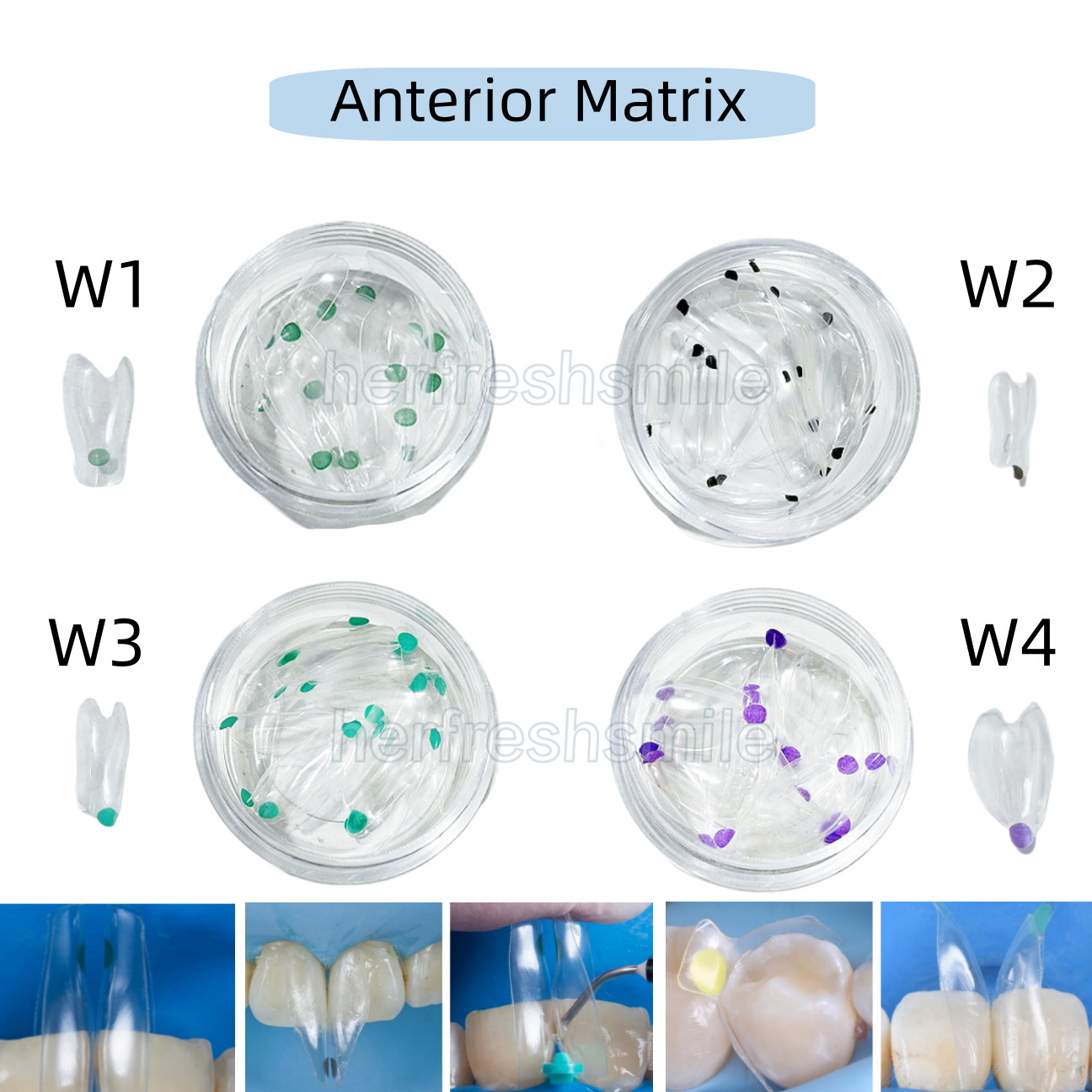 Dental Clear Matrix Transparent Restoration BT Bow Matrices Contoured BioClear