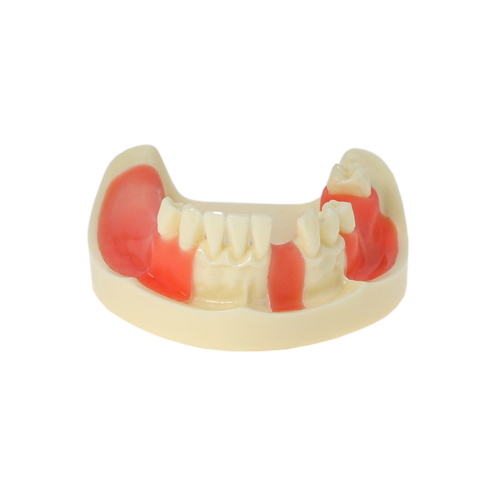 Dental Typodont Teeth Model Implant Pathological Perio Restoration Practice Demo