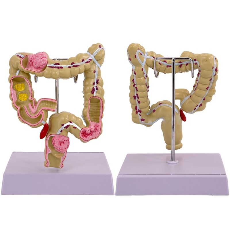 Human Large Intestine Model Teaching Model Medicals Supplies for School Study