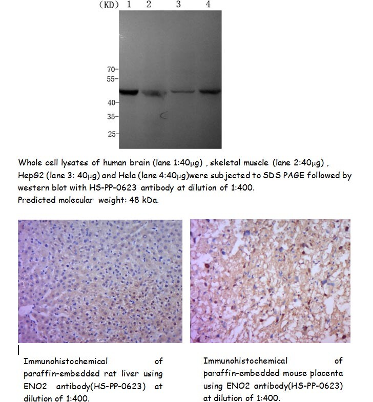 Rabbit anti-Human ENO2 Polyclonal Antibody, 100uL, www.sunnybiotechnology.com