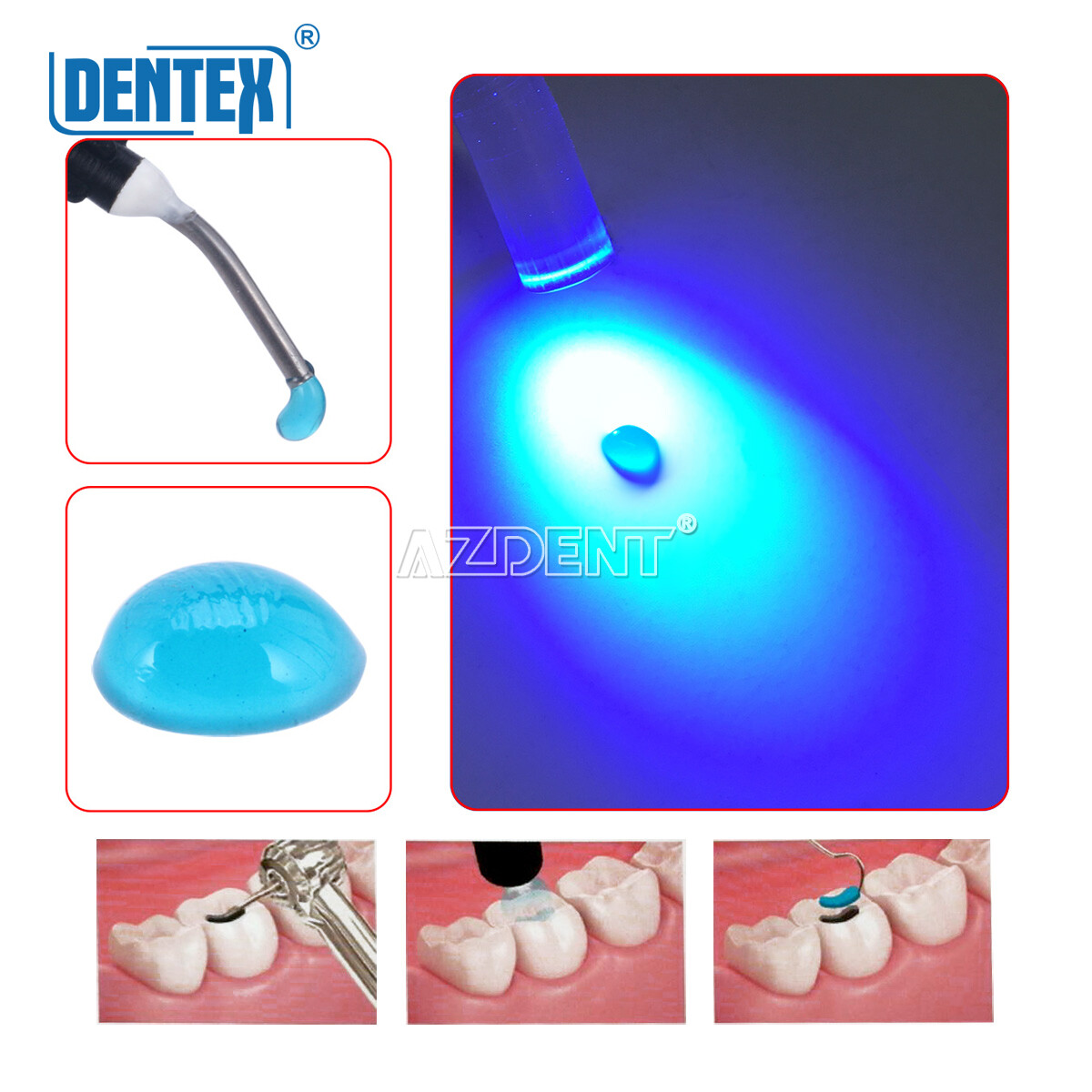 Dentex Dental Temporary Flow Composite Light Cure Filling Resin Blue Shade 2.5g